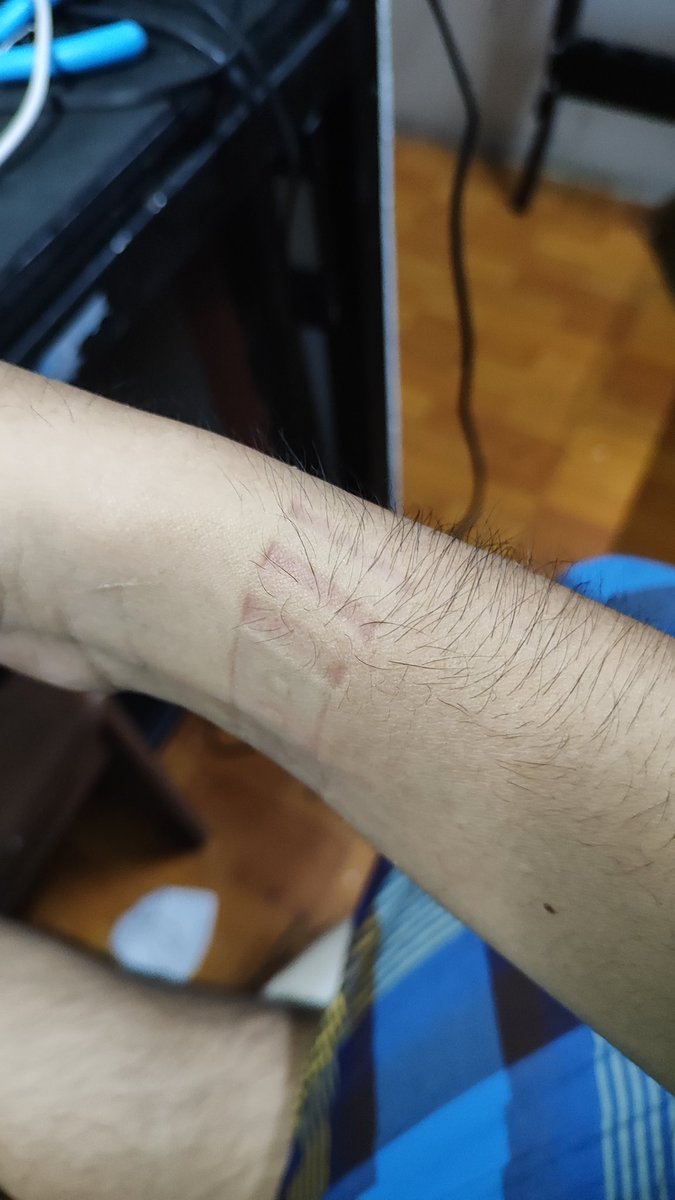 Ini strap konsepnya gimana co
