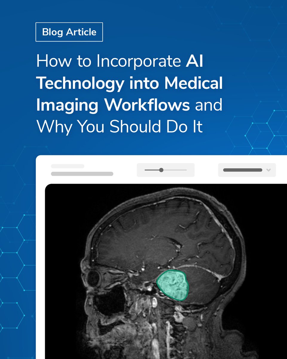 QMENTA_Inc's tweet image. 🧠🖥️ Explore AI&apos;s Impact on Medical Imaging.

See how AI is transforming image analysis and enhancing diagnostics. Read our latest blog for more details.

🔗 Start your AI journey today:  hubs.la/Q02Knf1B0 

#AIinHealthcare #AIIntegration #MedicalImagingTech