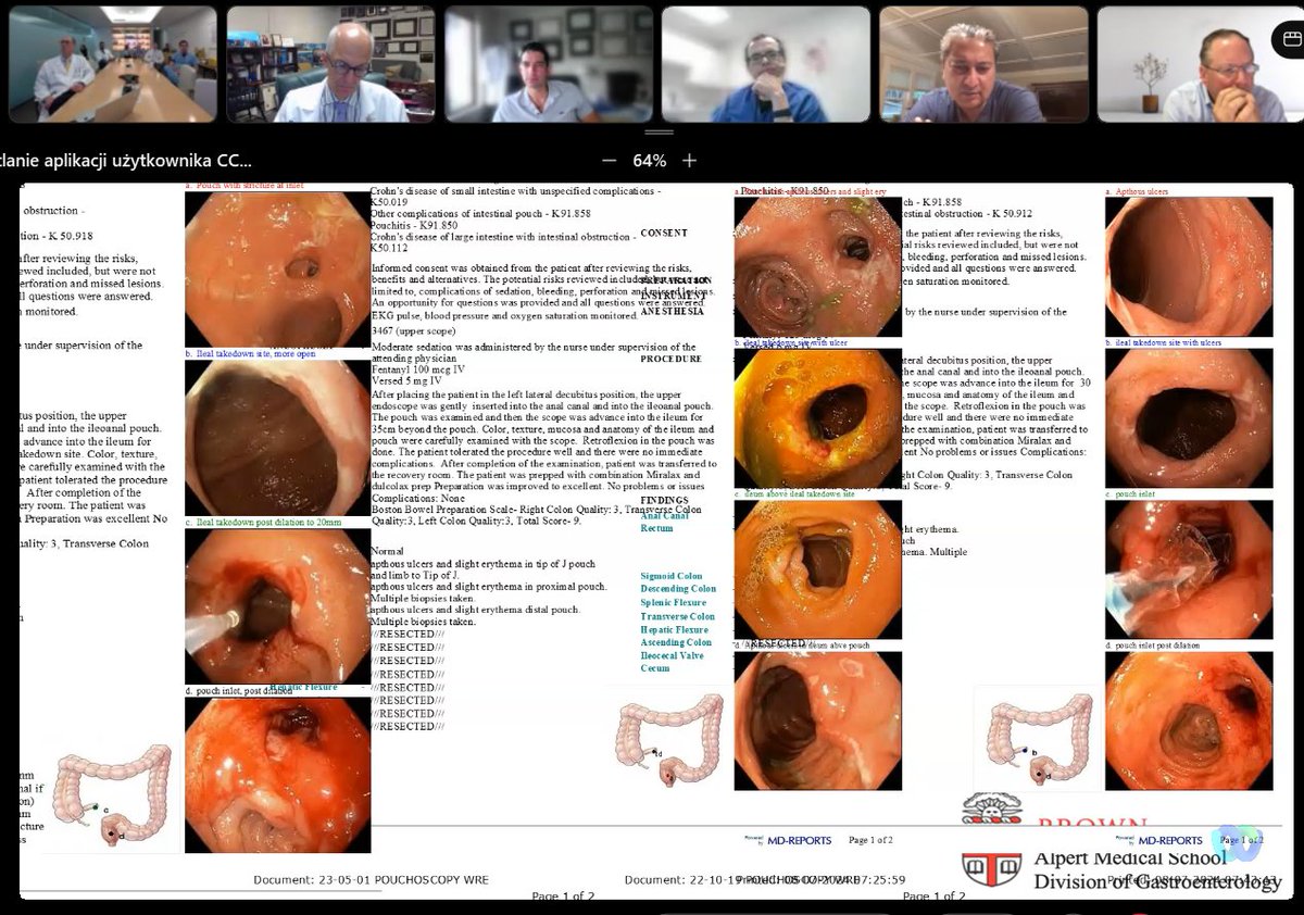 drRobinDud's tweet photo. Despite 🏝️🌞🌊holidays , another valuable meeting with @MRegueiroMD & #IBDologists from 🇺🇸
2⃣ instructive cases of pts with severe, complicated #IBD 💗a lot of knowledge🦉by @DrSamirAShah1 who took care⚕️ of them with improvement 👏🫶💪
Great talk by @BinionMd & @SWexner ✍️
@ibdlive #IBDlive @CleClinicMD