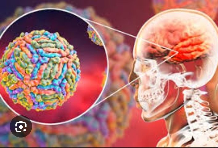 #Efemerides | #8Ago 
Día de la Encefalomielitis Miálgica Severa (EMS) 🌍
Hoy, 8 de agosto, conmemoramos el Día de la EMS, una enfermedad crónica que afecta a millones. La fatiga extrema, el dolor y los problemas cognitivos son solo algunos de sus síntomas.
#PuebloSonrienteYEnPaz