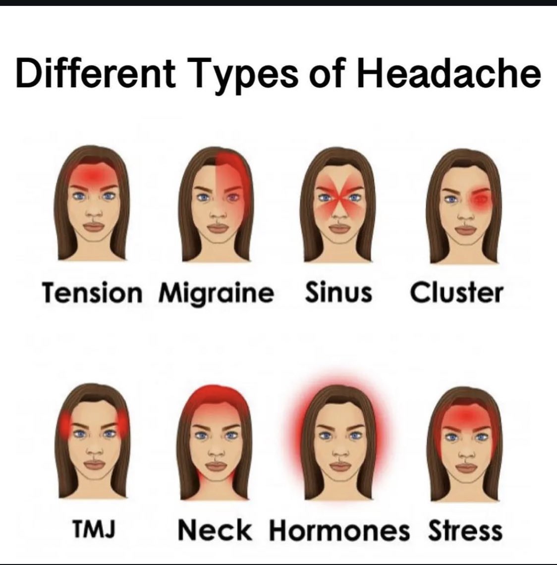 DrSrashtiJain's tweet photo. #physiotips
#typesofheadache https://t.co/7ulD5KlJu5