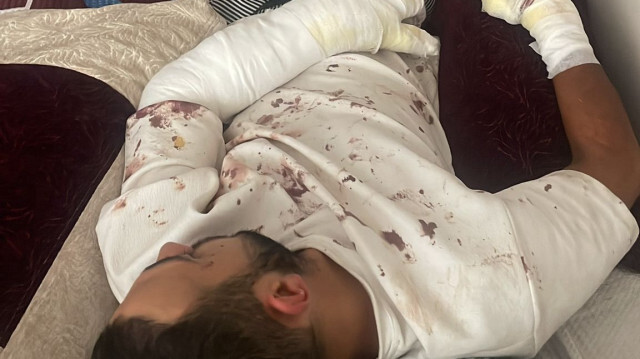 M_Boynukalin's tweet photo. Köpek saldırısına uğrayıp ölümden dönen gencin babası mama lobisine tepki gösterdi: Çocukların hayatı bunların umurunda değil https://t.co/RilFCg7VhM https://t.co/jroTqTYd2O