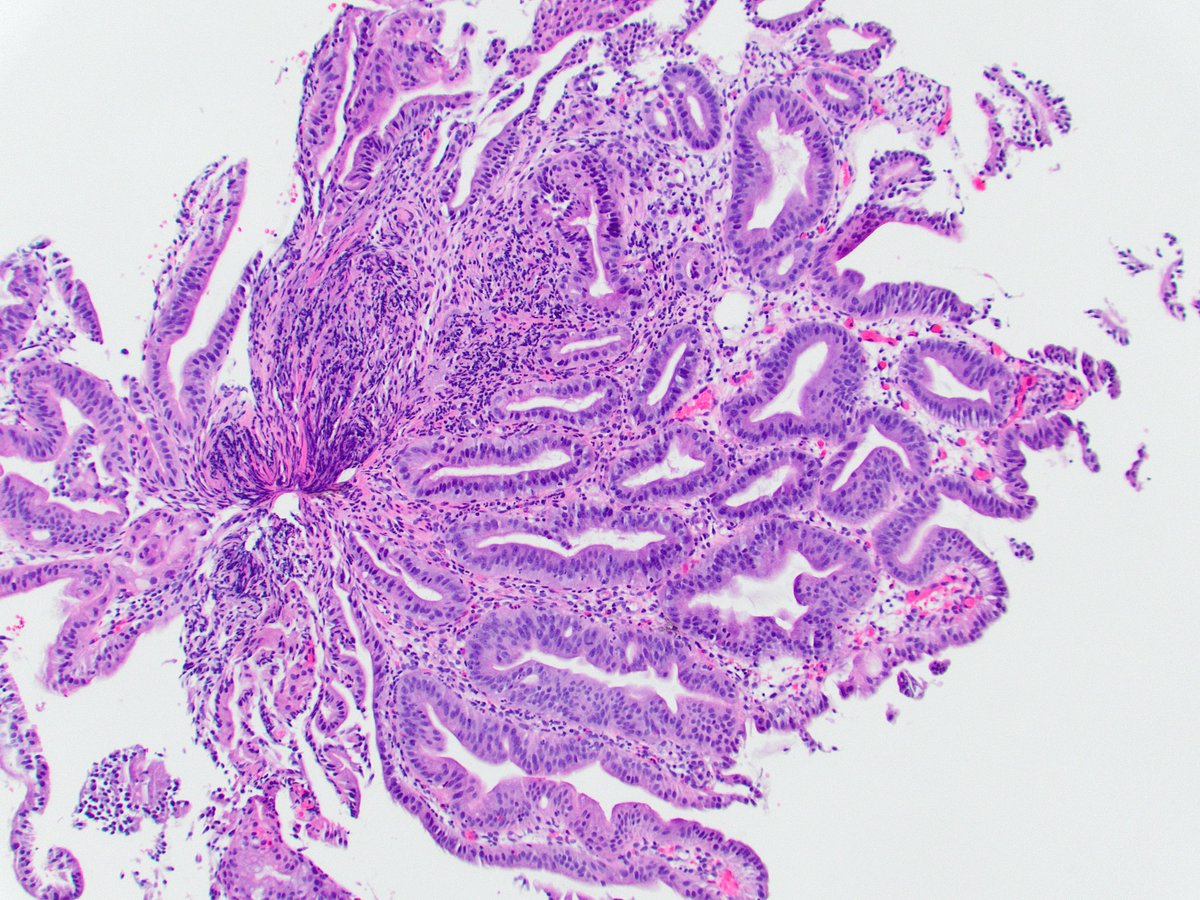 Raul S. Gonzalez, MD tweet media