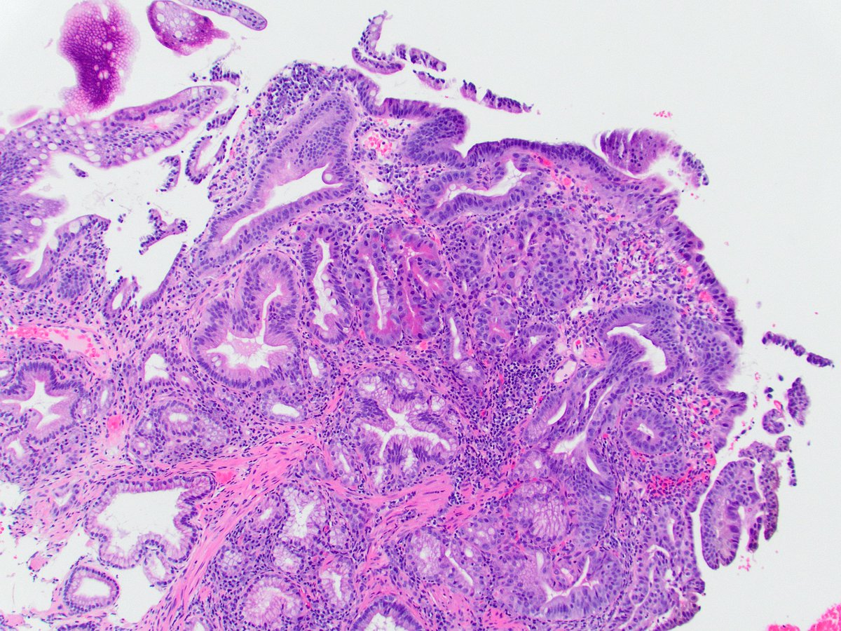 Raul S. Gonzalez, MD tweet media