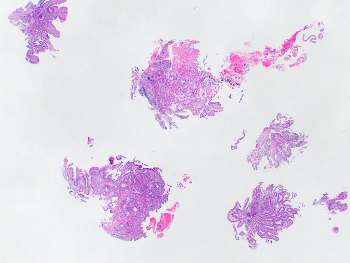 Raul S. Gonzalez, MD tweet media