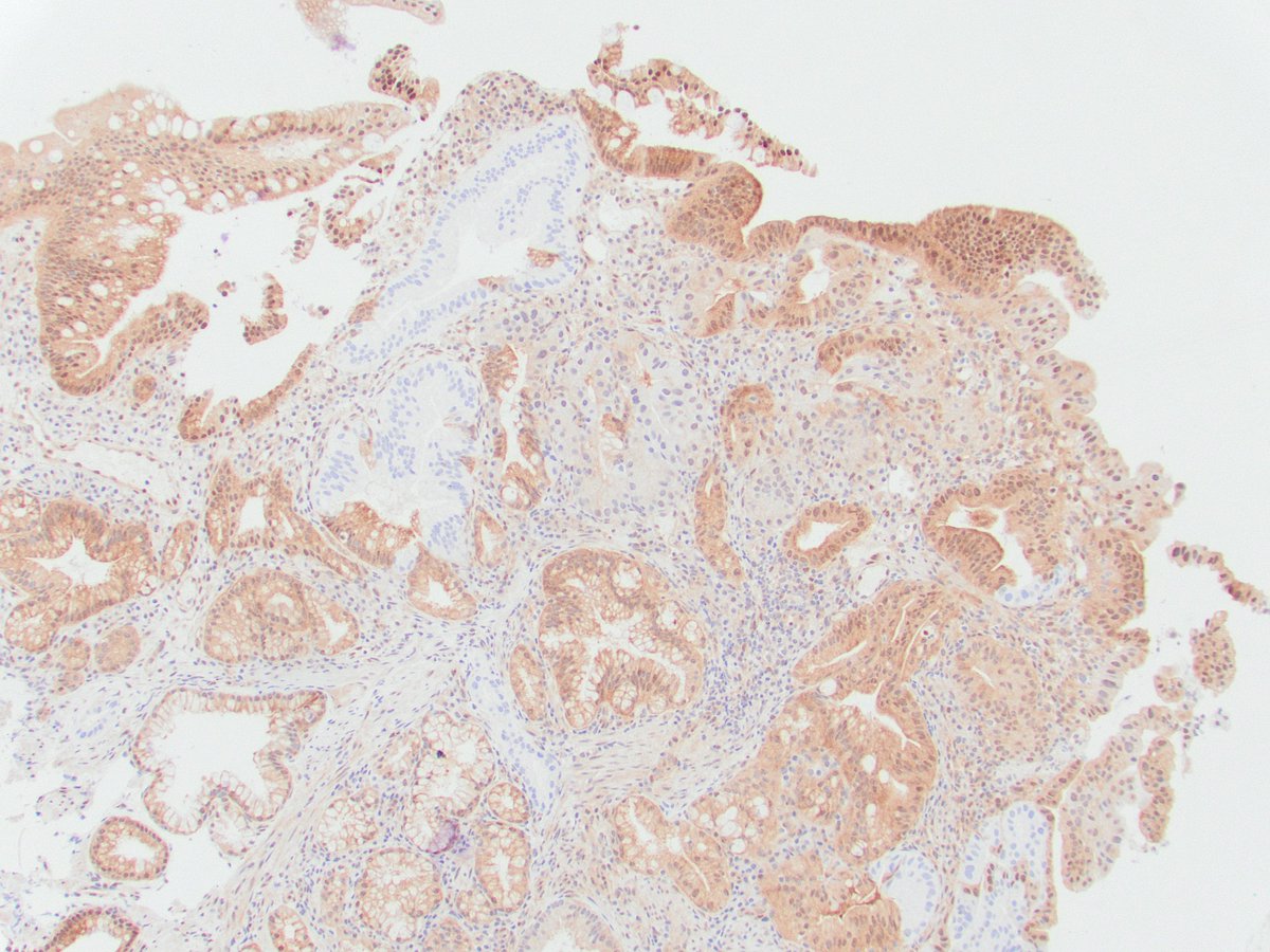 Raul S. Gonzalez, MD tweet media