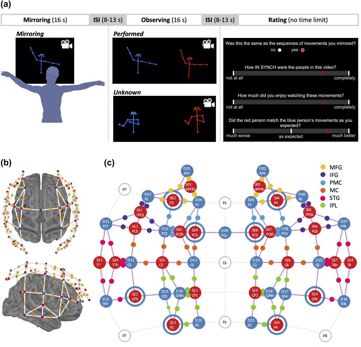 NIRx Medical Tech. (@nirx_nirs) on Twitter photo 👯Fantastic recent research by @RyssaMoffat & <a href="/brain_on_dance/">Emily S. Cross</a> on the neuroaesthetics of synchronous movement.
🧠They used #fNIRS to measure effects in the action-observation network within the brain.
Check out their publication and findings here 👀onlinelibrary.wiley.com/doi/10.1002/hb… 👯Fantastic recent research by @RyssaMoffat & <a href="/brain_on_dance/">Emily S. Cross</a> on the neuroaesthetics of synchronous movement.
🧠They used #fNIRS to measure effects in the action-observation network within the brain.
Check out their publication and findings here 👀onlinelibrary.wiley.com/doi/10.1002/hb…