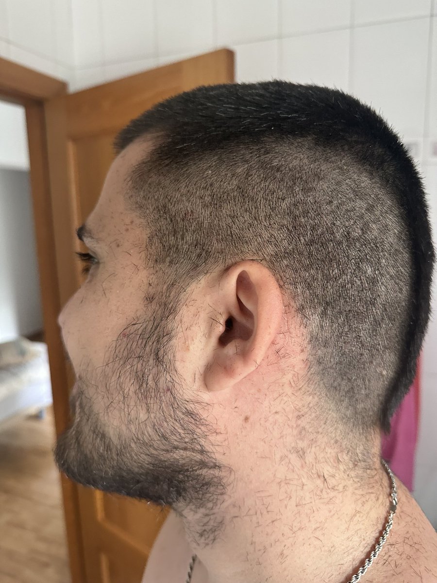 SirMaza's tweet photo. Literalmente tengo muchísimo pelo, dejad de llamarme calvo https://t.co/71B0brrEhm