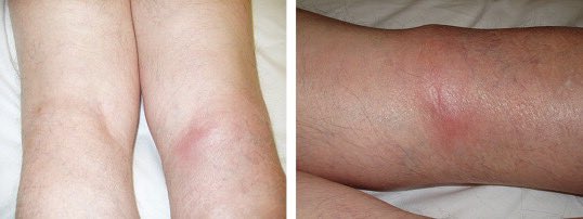 أحيانا حالة واحدة كهذه قد تعطيك دروسا عظيمة وتغير نظرتك في كيفية ممارسة المهنة لأخر العمر.

لو أن أحد أفراد عائلتها تبرع بإقناعها أن لا ضرورة لزيارة طبيب الأسنان لماتت في المنزل وسط نافورة دماء ولربما احتاجت للطب الشرعي بعد وفاتها لإثبات أنها لم تمت مقتولة. 

تذكرت قصة مشابهة