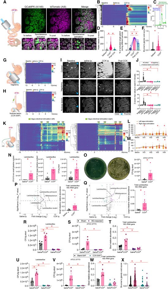 LabWaggoner's tweet photo. Stress leads to disarray of the gut microbiome, which in turn causes inflammation and a drop in the body’s ability to fend off infection 
Comment @Nature on @CellCellPress 
https://t.co/5engHbTTGq https://t.co/1ApvlBfB7K