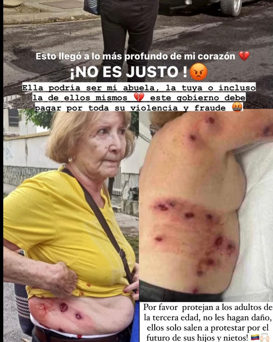 Sirs  <a href="/Almagro_OEA2015/">Luis Almagro</a> <a href="/KarimKhanQC/">Karim A. A. Khan KC</a> <a href="/ONU_es/">Naciones Unidas</a> <a href="/CorteIDH/">Corte Interamericana de Derechos Humanos</a> <a href="/CNNEE/">CNN en Español</a> <a href="/soyfdelrincon/">Fernando Del Rincon</a> This is cruel for an elderly woman, shooting them like this, marking their life, this is unforgivable, Venezuela needs justice to be done.