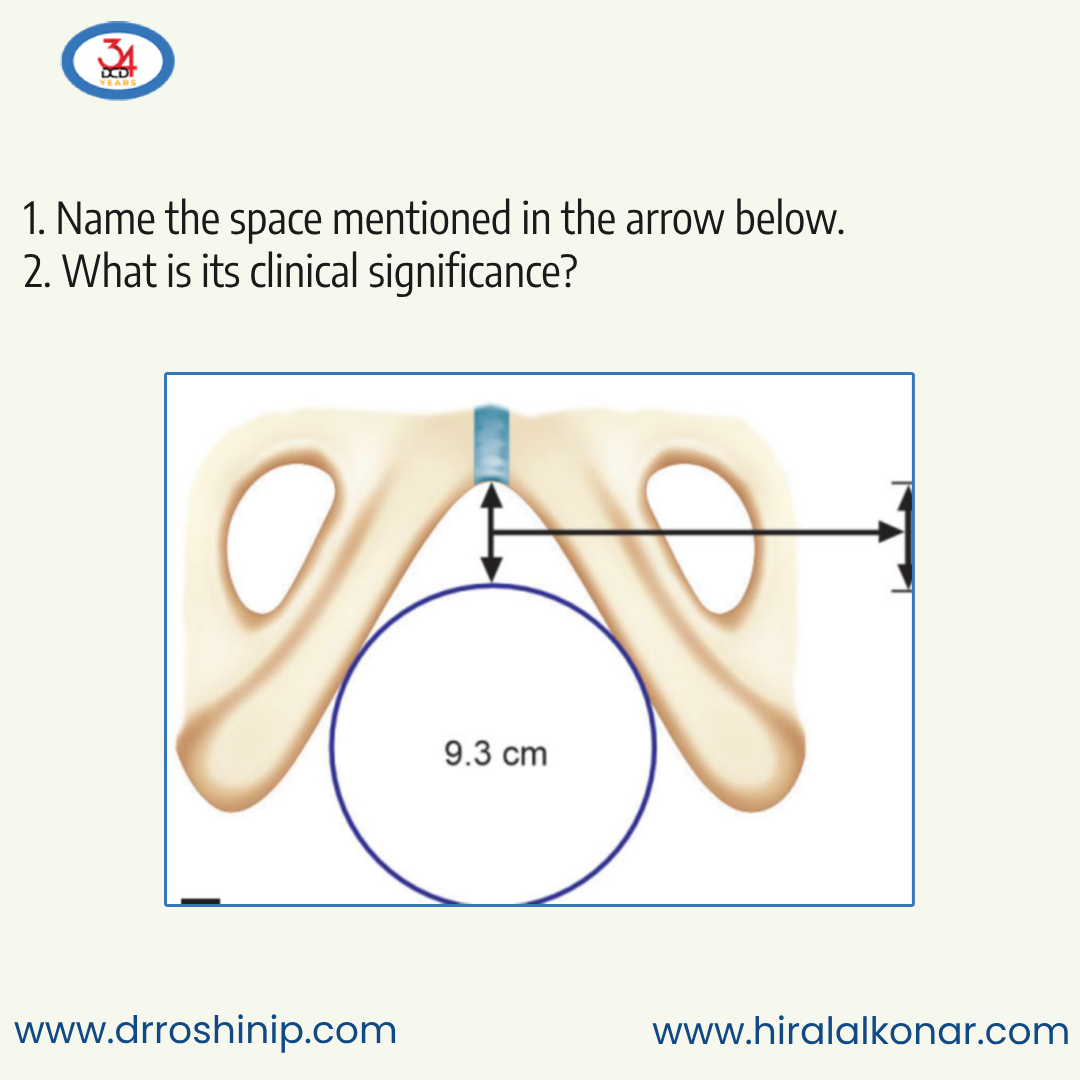 DCDuttaBooks's tweet photo. 1. Name the space mentioned in the arrow below.
2. What is its clinical significance?

Follow us to learn more.

Reference:
https://t.co/RxcI42ejYY

https://t.co/tq8w9ygzah

#neetpg2024 #NEETPG #neetpg24 #NEETPGPreparation  #chandrachurkonar #drroshinip https://t.co/osOfkMKdkN