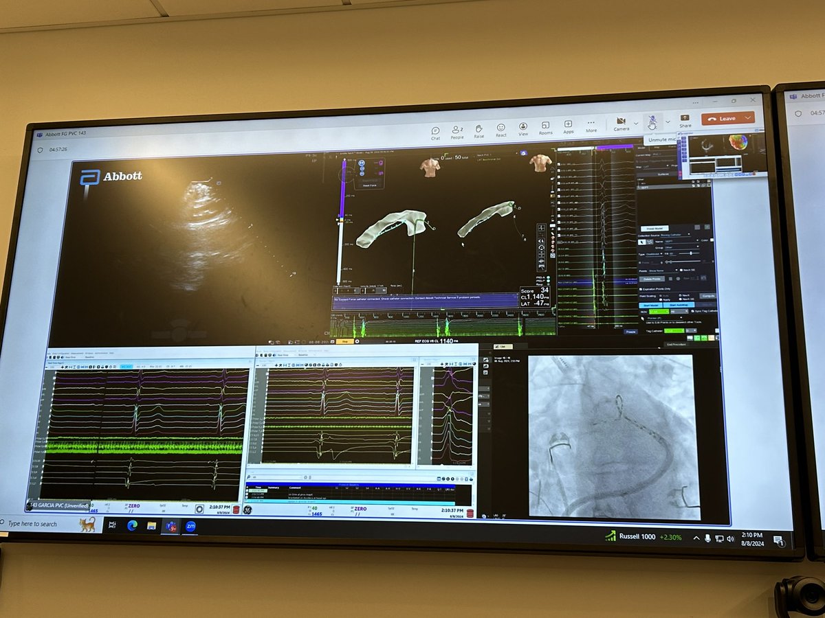 Andres Enriquez (@andresenriqueza) on Twitter photo Abbott VT course. Two days of complex live cases at <a href="/PennCardiology/">Penn Cardiology</a> <a href="/DrMatthewHyman/">Matthew Hyman</a> <a href="/Dr_Markman/">Timothy Markman</a> <a href="/DrFerminGarcia/">Fermin Carlos Garcia</a> <a href="/CMTschabrunn/">Cory M. Tschabrunn</a> Abbott VT course. Two days of complex live cases at <a href="/PennCardiology/">Penn Cardiology</a> <a href="/DrMatthewHyman/">Matthew Hyman</a> <a href="/Dr_Markman/">Timothy Markman</a> <a href="/DrFerminGarcia/">Fermin Carlos Garcia</a> <a href="/CMTschabrunn/">Cory M. Tschabrunn</a>