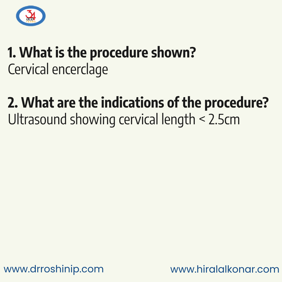 DCDuttaBooks's tweet photo. 1. What is the procedure shown?
2. What are the indications of the procedure?

Follow us to learn more.

Reference:
https://t.co/RxcI42ejYY

https://t.co/tq8w9ygzah

#neetpg2024 #NEETPG #neetpg24 #NEETPGPreparation #MedicalBooks #DCD #chandrachur #chandrachurkonar #drroshinip https://t.co/BEe7qpqwrc