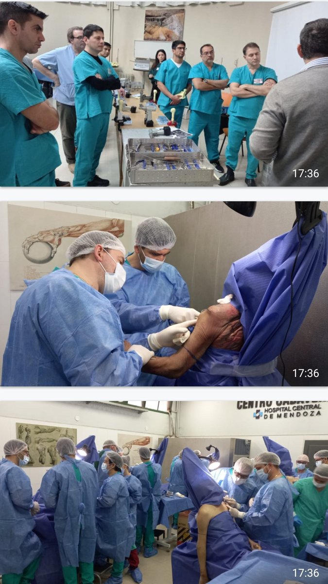 Intensa actividad 1er día de curso Cadaverico de Hombro en Mendoza! AAHyC.