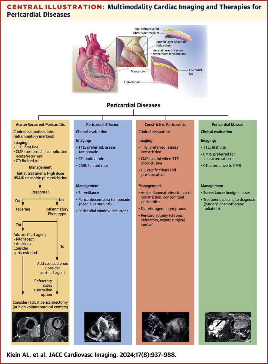 🔑 The spectrum of pericardial disorders encompasses pericardial inflammation, effusion, constriction, masses, and congenital anomalies.

Read more key points from an international position statement on multimodality imaging for pericardial disease: bit.ly/4dx48AP