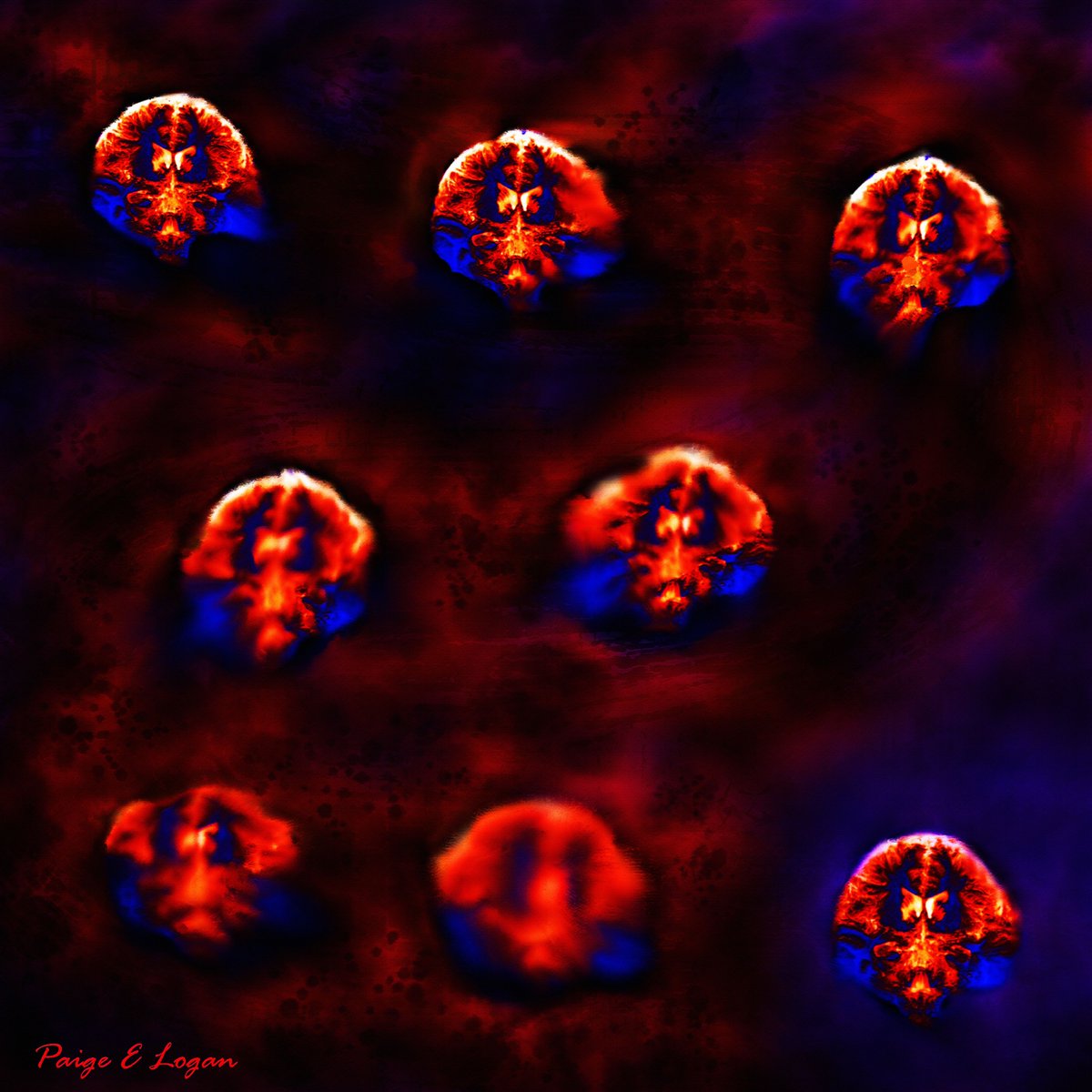 _paigely's tweet photo. I presented science this year at #AAIC24 and also had the opportunity to present my art at the very first Art at  AAIC! 

I am excited to share my digital art piece "But There is Hope" with you all 👩‍🎨 https://t.co/BgnUvJwub7