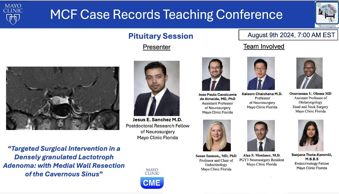 Join us tomorrow at MCF Case Records!! An amazing case will be presented by <a href="/JEmilianoSG/">J. Emiliano Sanchez-Garavito M.D.</a> 
<a href="/MayoClinicNeuro/">Mayo Clinic Neuro</a> 
<a href="/DoctorQMd/">Dr. Alfredo Quiñones-Hinojosa</a> <a href="/joao_p_almeida/">Joao Paulo Almeida</a> <a href="/adrian_safa/">Adrian Safa M.D.</a> <a href="/jpnavarro_md/">Juan P. Navarro-Garcia de Llano</a> <a href="/lmichmd/">Loizos Michaelides, MD</a> <a href="/paosmeade/">Paola Suárez Meade, MD</a> <a href="/ekert_justyna/">Justyna Ekert</a> <a href="/janhachmann/">Jan Hachmann MD MS MBA</a>