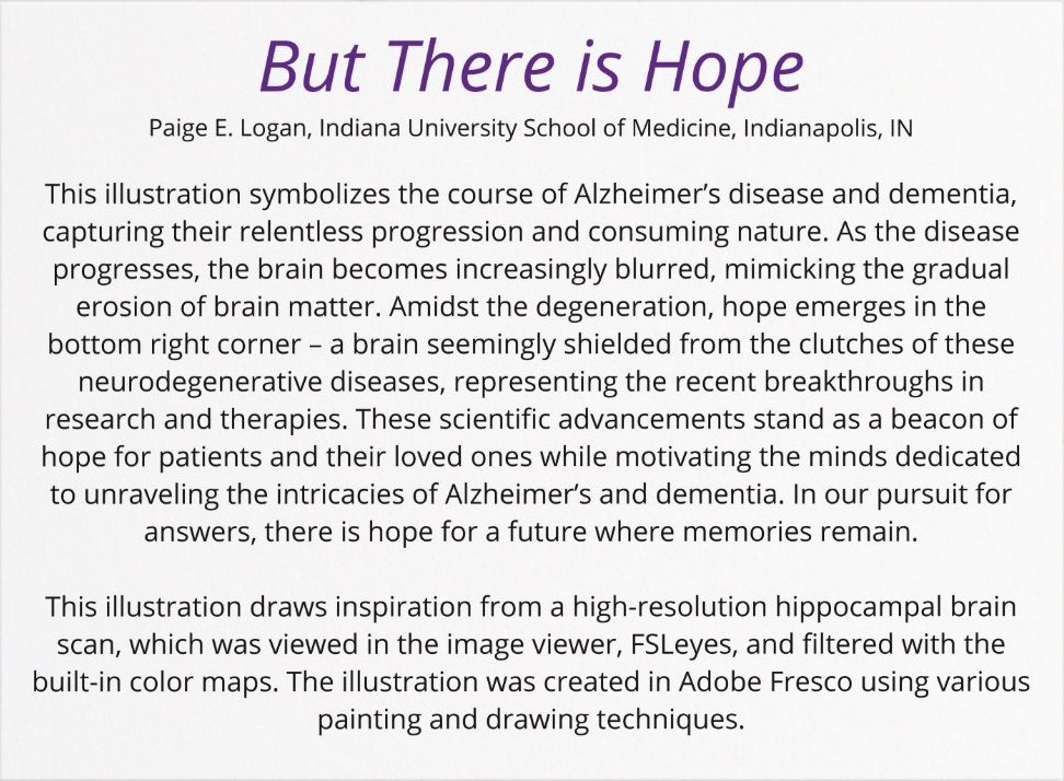 _paigely's tweet photo. I presented science this year at #AAIC24 and also had the opportunity to present my art at the very first Art at  AAIC! 

I am excited to share my digital art piece "But There is Hope" with you all 👩‍🎨 https://t.co/BgnUvJwub7