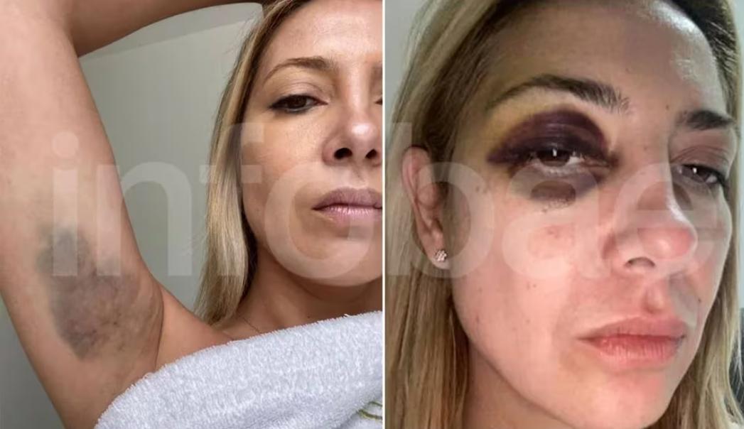 Los cómplices?
Los que sabían y no hicieron nada?
Los que taparon porque estaban en campaña?
Los médicos?