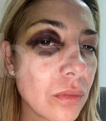 Trumperizar's tweet photo. El Ministerio de la Mujer no servía ni para proteger a la PRIMERA DAMA.

GRACIAS MILEI POR CERRAR ESE ANTRO DE PARÁSITOS. https://t.co/OeFeVSQYgO
