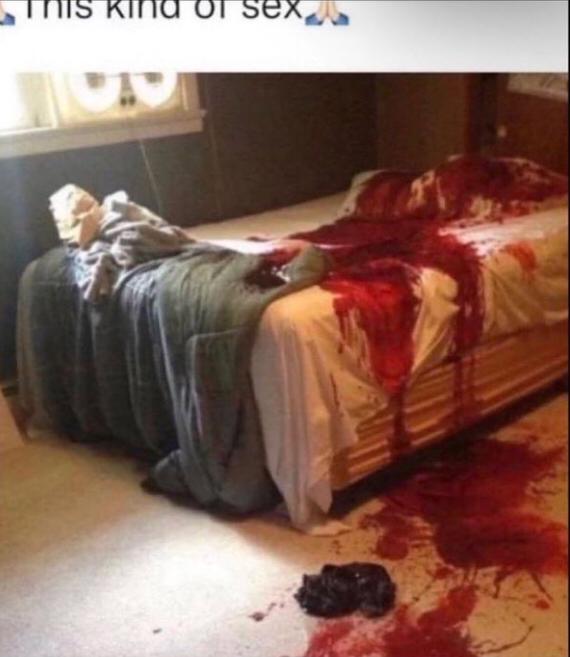 bl00dyann's tweet photo. #bdsm #blood #bloodysex https://t.co/eWoGB3fl6P