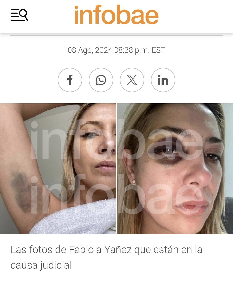 MartaGa34757552's tweet photo. Ninguna de las 2 basuras 
#Mazzina y #GomezAlcorta la ayudaron, ni a Fabiola ni a ninguna mujer!!!
@sandraborghi70 
@JonatanViale https://t.co/b1AllFnk6H
