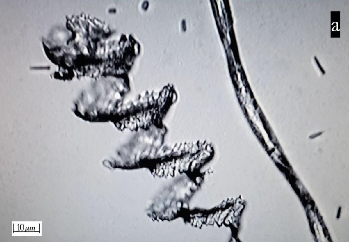 Died Suddenly tweet media