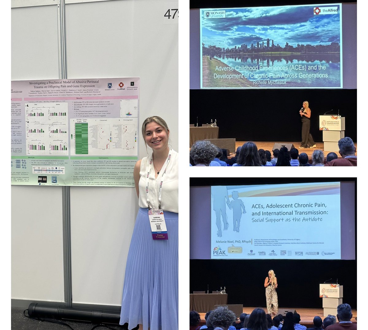 Sabrina Salberg (@salbergsabrina) on Twitter photo Grateful to attend <a href="/IASPpain/">IASP</a> and present some of the work coming out of our lab🐁 As always, incredible presentations by my fabulous mentors <a href="/richelle_ndopl/">Richelle Mychasiuk</a> and <a href="/MelanieNoel/">Dr. Melanie Noel</a> 👩🏼🔬 #WC2024 Grateful to attend <a href="/IASPpain/">IASP</a> and present some of the work coming out of our lab🐁 As always, incredible presentations by my fabulous mentors <a href="/richelle_ndopl/">Richelle Mychasiuk</a> and <a href="/MelanieNoel/">Dr. Melanie Noel</a> 👩🏼🔬 #WC2024