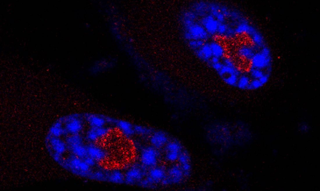 talius's tweet image. Study identifies #RNA molecule that #Regulates #Cellular #Aging 

Researchers discovered a new way cells regulate senescence, which could lead to interventions for aging-related conditions like neurodegenerative, CVD, diabetes, cancer &amp;amp; ribosomopathies.. scitechupdates.com/study-identifi…