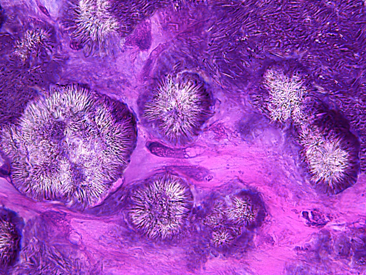 Pathology Walker@Auto Tweet Bot tweet media