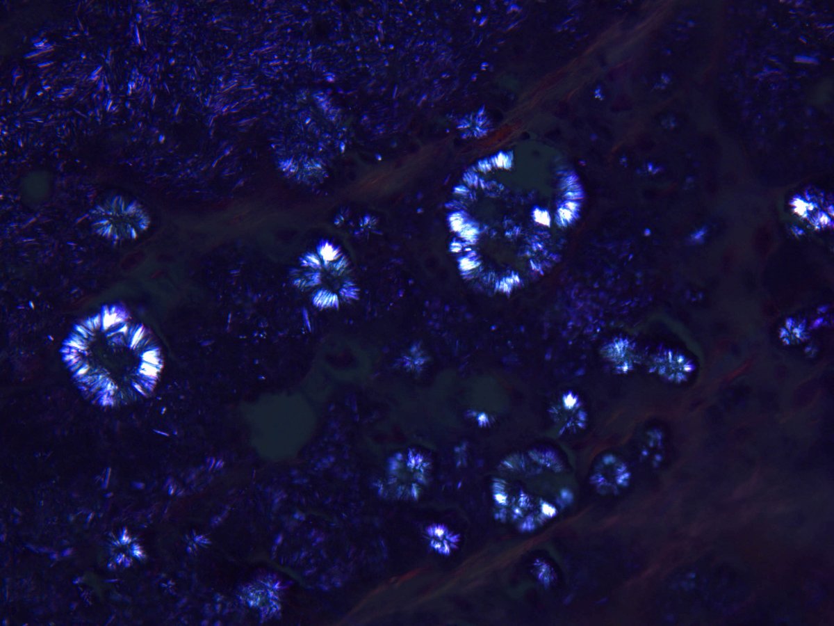 Pathology Walker@Auto Tweet Bot tweet media