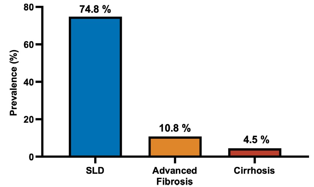 Rohit Loomba (@drloomba) on Twitter photo Four years of work- Key paper to read
Prevalence of steatotic liver disease, advanced fibrosis and cirrhosis among community-dwelling overweight and obese individuals in the USA gut.bmj.com/content/early/… <a href="/AASLDtweets/">AASLD</a> <a href="/EASLnews/">EASLnews</a> <a href="/INASL_Liver/">INASL</a> <a href="/DrHuangDQ/">Daniel Huang</a> <a href="/f_tavaglione/">Federica Tavaglione</a> <a href="/UCSD_GI/">UCSD Gastroenterology</a> Four years of work- Key paper to read
Prevalence of steatotic liver disease, advanced fibrosis and cirrhosis among community-dwelling overweight and obese individuals in the USA gut.bmj.com/content/early/… <a href="/AASLDtweets/">AASLD</a> <a href="/EASLnews/">EASLnews</a> <a href="/INASL_Liver/">INASL</a> <a href="/DrHuangDQ/">Daniel Huang</a> <a href="/f_tavaglione/">Federica Tavaglione</a> <a href="/UCSD_GI/">UCSD Gastroenterology</a>