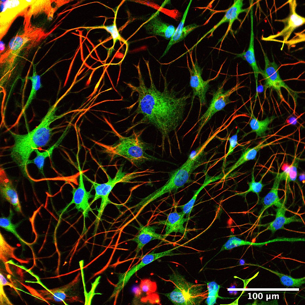 And since it's #FluorescenceFriday we'd love to share a beautiful image of iPSC-derived astrocytes featured in our new preprint (Green = GFAP, Red = S100B, Blue = DAPI)!  
Image credit: talented PhD student <a href="/alexlish47/">Alex Lish</a> 😎