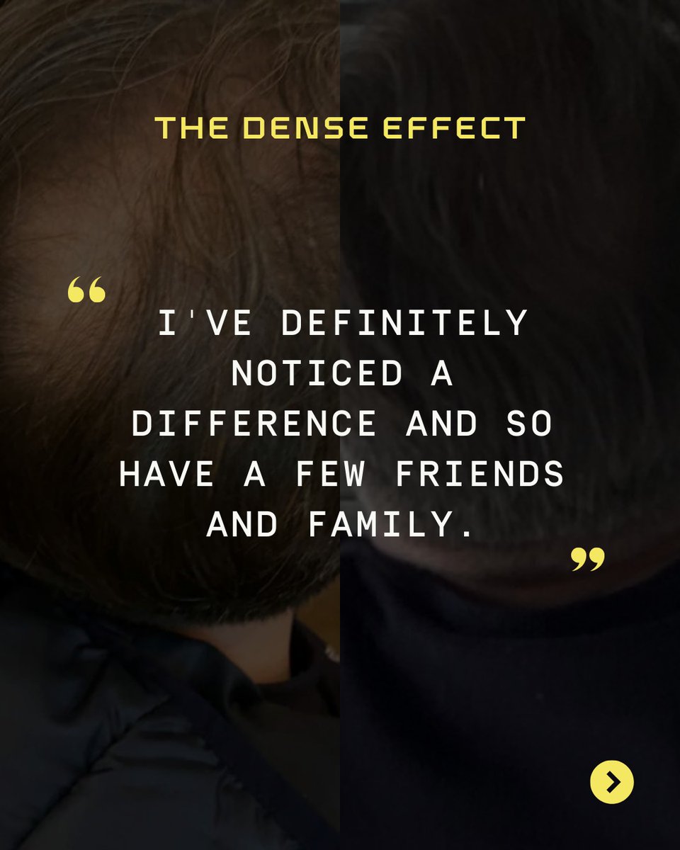 Dense Hair Experts tweet media