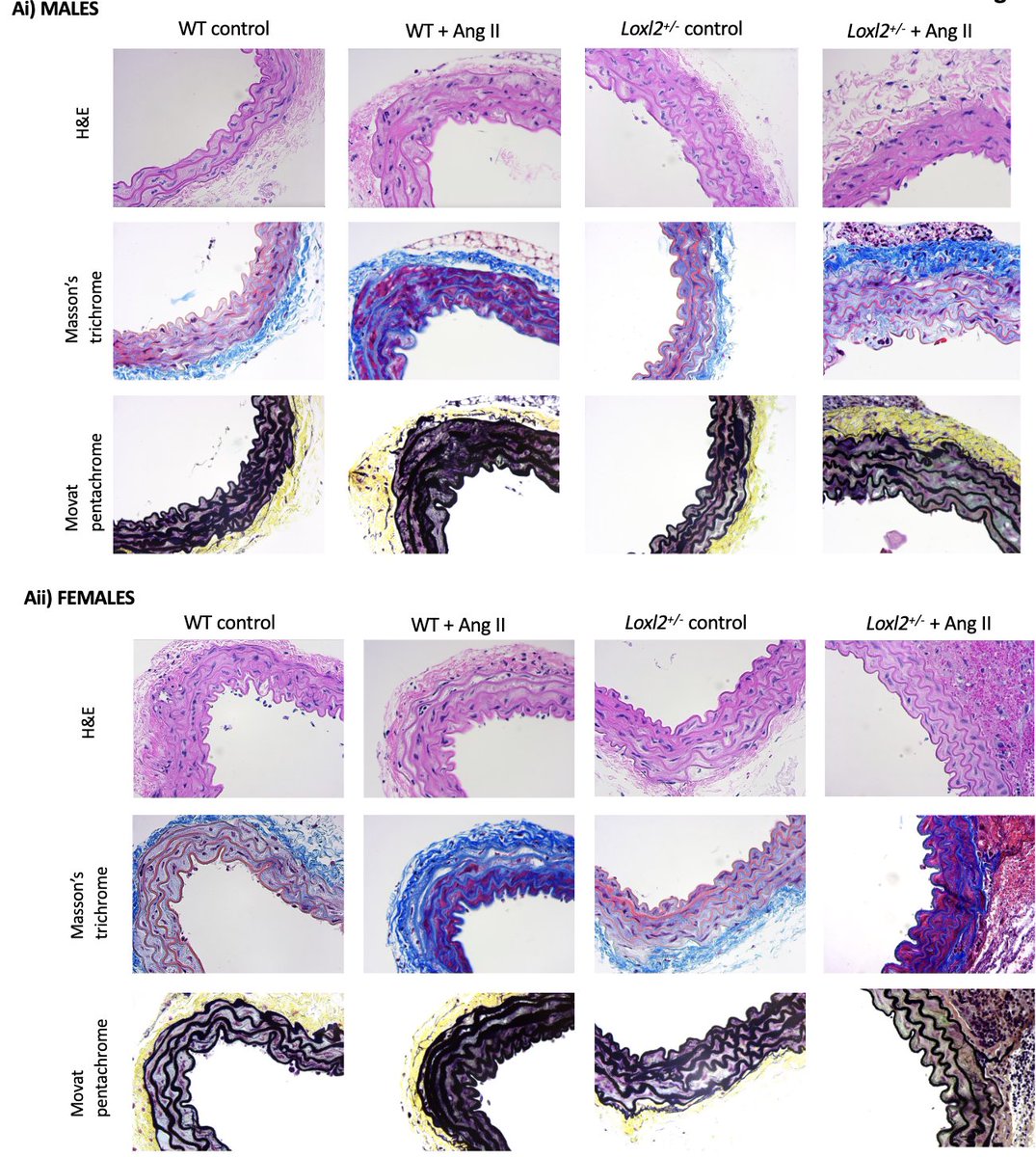 AJP-Heart and Circ tweet media