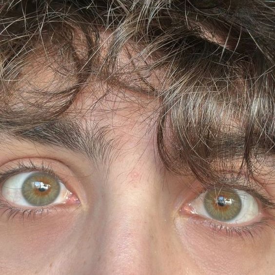 SCTaima's tweet photo. Cuando se superan esos ojos? https://t.co/0nzjN47EAW