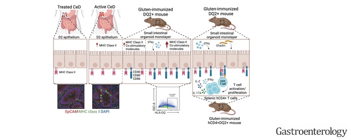 Verdu Lab (@verdulab) on Twitter photo 📢NEW PAPER ALERT📢
Our latest paper in <a href="/AGA_Gastro/">Gastroenterology</a> sheds light on the immune role of the #intestinal epithelium in #celiacdisease by our talented Sara Rahmani <a href="/MsOrganoid/">Sara Rahmani</a> <a href="/Farncombe_GI/">Farncombe Institute</a> @Didarlab <a href="/FernandoChirdo/">Fernando Chirdo</a> <a href="/McMasterU/">McMaster University</a> #organoid
Check it out here:
gastrojournal.org/article/S0016-…
⬇️ 📢NEW PAPER ALERT📢
Our latest paper in <a href="/AGA_Gastro/">Gastroenterology</a> sheds light on the immune role of the #intestinal epithelium in #celiacdisease by our talented Sara Rahmani <a href="/MsOrganoid/">Sara Rahmani</a> <a href="/Farncombe_GI/">Farncombe Institute</a> @Didarlab <a href="/FernandoChirdo/">Fernando Chirdo</a> <a href="/McMasterU/">McMaster University</a> #organoid
Check it out here:
gastrojournal.org/article/S0016-…
⬇️