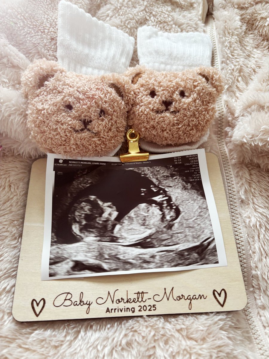 Our little dream 🐻☁️🧺

Baby Norkett-Morgan  - February 2025 🤍 <a href="/tommorgs12/">Tommy Morgan</a>