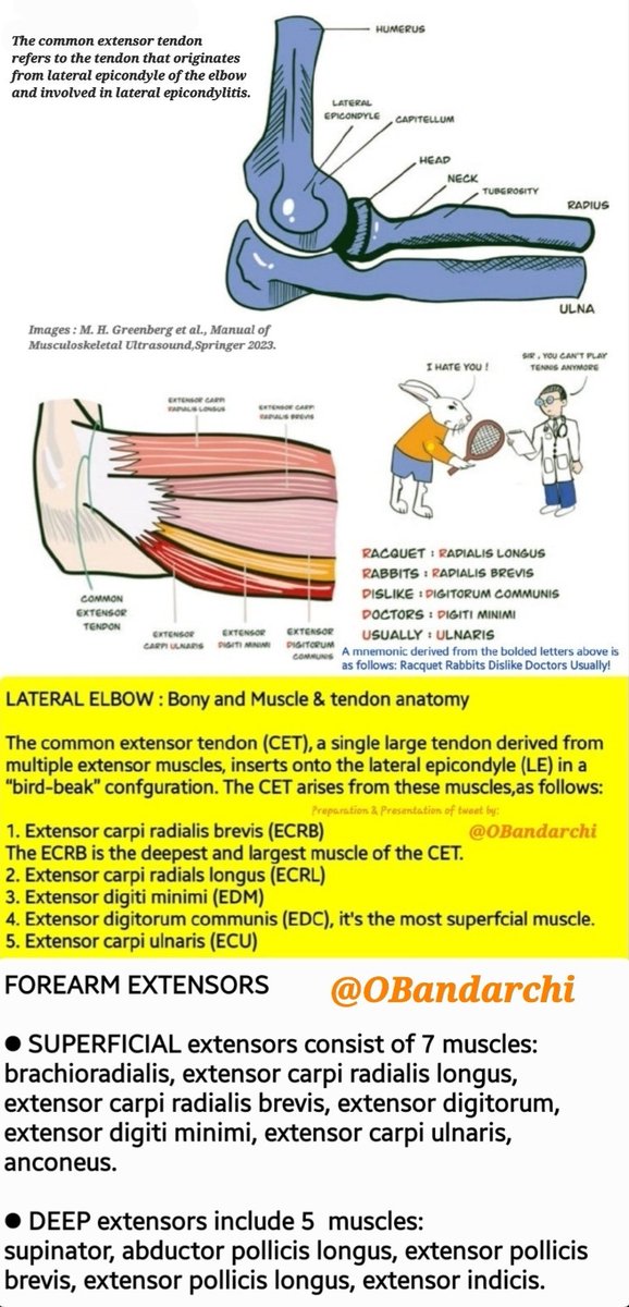 OBandarchi's tweet photo. The common extensor tendon refers to the tendon originating from lateral epicondyle of the elbow and the fibers of 5 muscles come together to form the common extensor tendon.

The most frequent pathology of the common extensor tendon is lateral epicondylitis. https://t.co/Xj6bM8bEo2