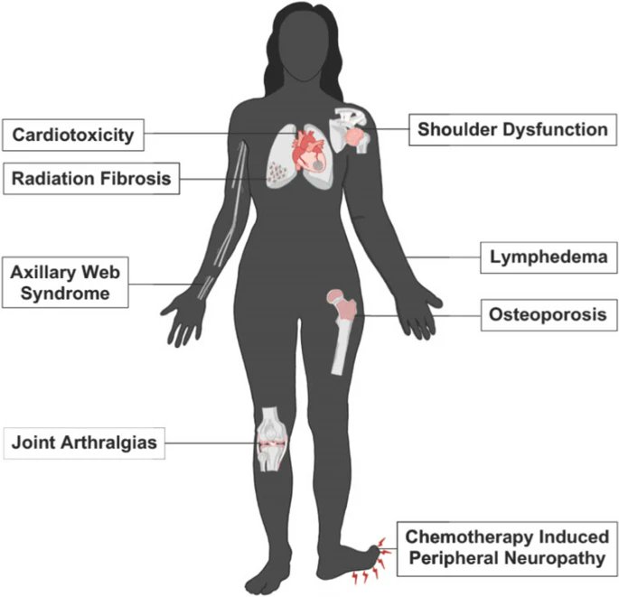 NCI Office of Cancer Survivorship (@ncicancersurv) on Twitter photo In this recent analysis of over 55,000 breast cancer survivors, <a href="/NCICancerSurv/">NCI Office of Cancer Survivorship</a> Deputy Director Dr Michelle Mollica & coauthors found that only 33% received rehabilitation services in the first 11 months after their cancer diagnosis. Read more link.springer.com/article/10.100… @jcancersurv In this recent analysis of over 55,000 breast cancer survivors, <a href="/NCICancerSurv/">NCI Office of Cancer Survivorship</a> Deputy Director Dr Michelle Mollica & coauthors found that only 33% received rehabilitation services in the first 11 months after their cancer diagnosis. Read more link.springer.com/article/10.100… @jcancersurv