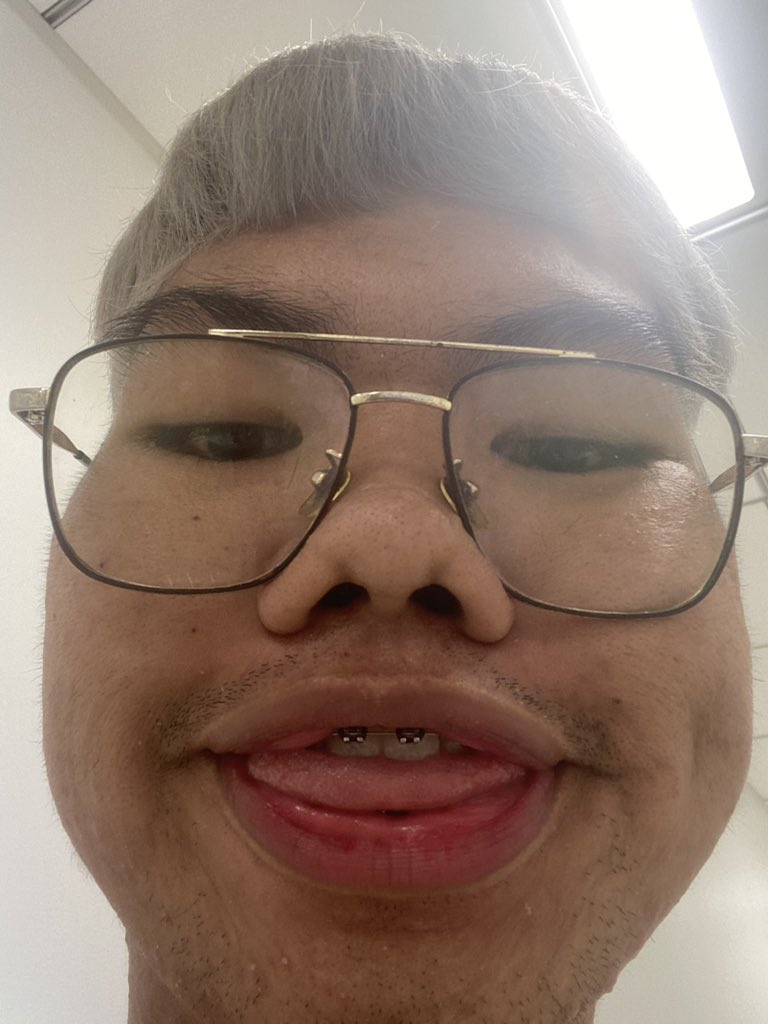 danieljzrl's tweet photo. Hi :)) https://t.co/5azl7tI7OI