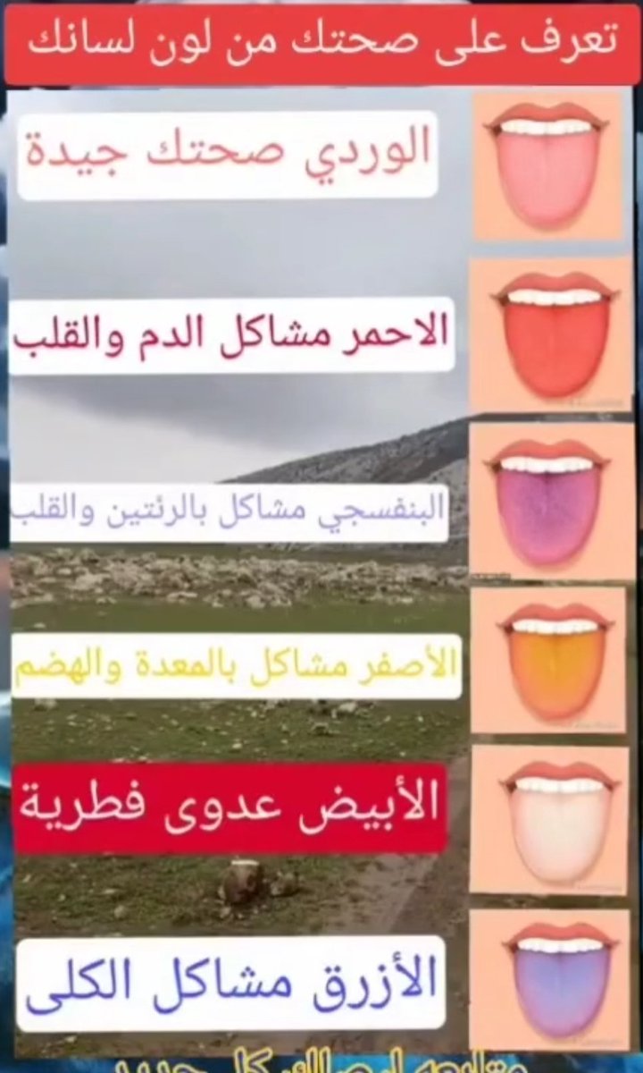 تعرف على صحتك من لون لسانك
