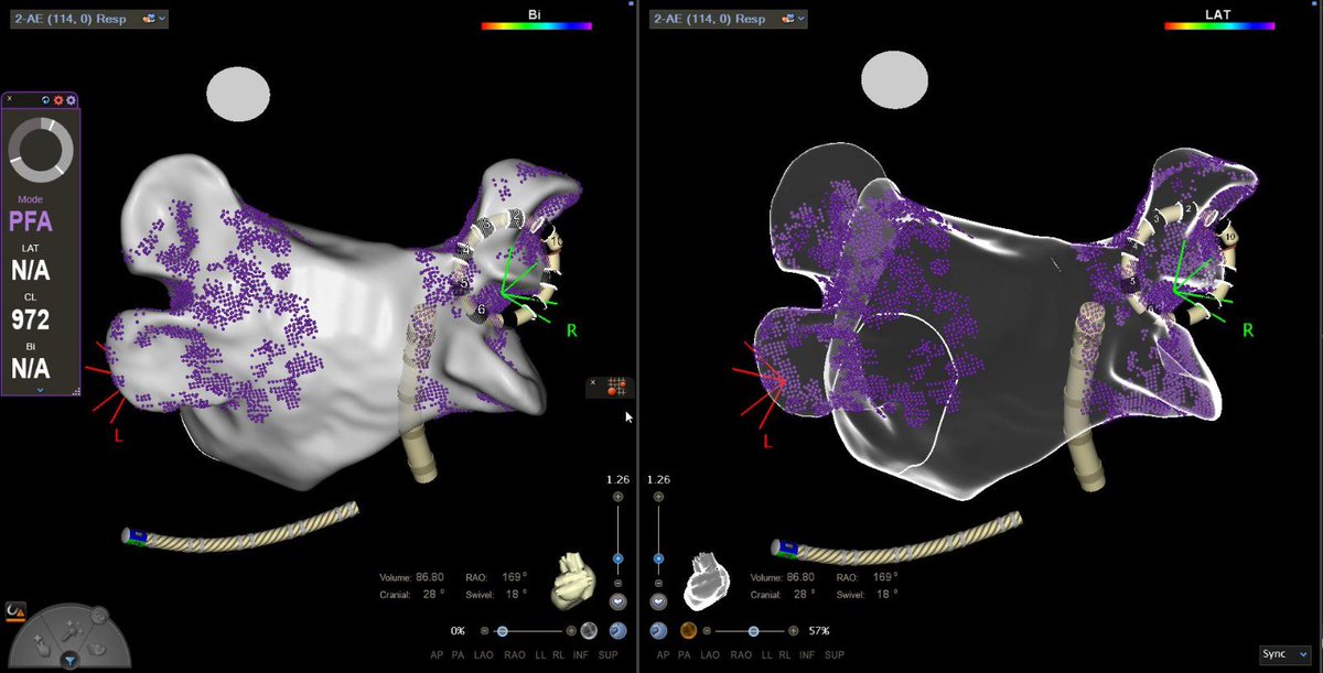 Life_activist_'s tweet photo. Á descoberta de boas energias no final da semana!!
#eletroporação #varipulse #biosenseWebster @cgmarinescu @Tomasbiosense @guilhermeFlor @CheilaThompson https://t.co/JaDCKcC9yT