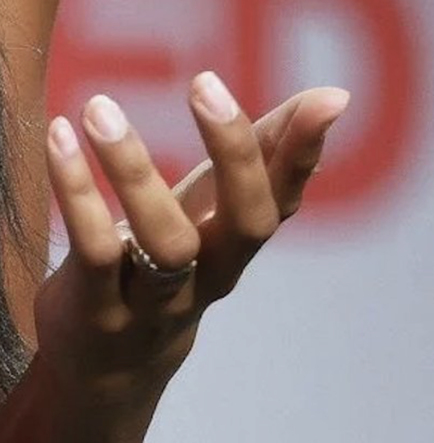 This is the worst quality this kind of image will be. They keep getting better.