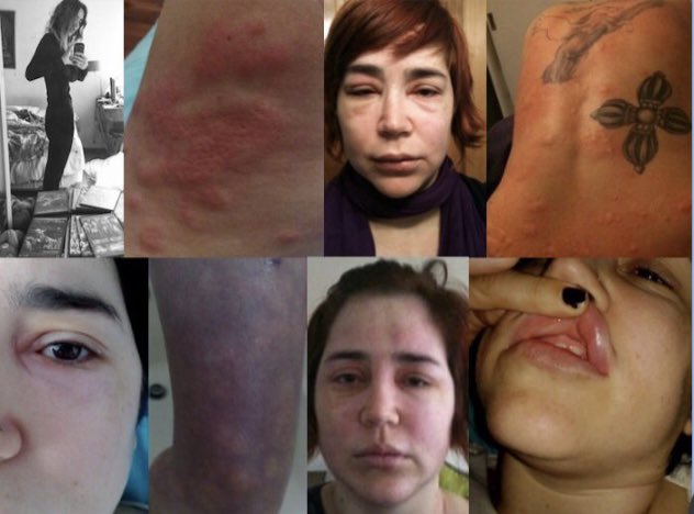 FranBrivio's tweet photo. ¡Bendita seas, María! 🌿✨ Seguimos luchando por el #accesoreal a la #cannabis, incluyendo el autocultivo. Pero además un lote de THC lleva mes y medio en aduanas, afectando a pacientes que no podemos acceder a las gotas y otras vías. @Minsa_Peru 

*Última foto es antes de 🌱 https://t.co/XAU4MUYCrP