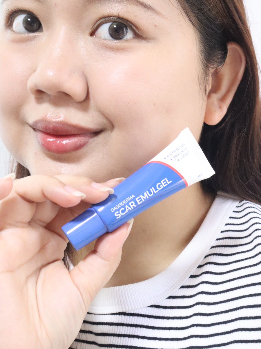 yingpeereview's tweet photo. บางทีเวลามีรอยสิวก็ทำให้ไม่มั่นใจ
〰️ DAGODERMA Scar Emulgel
หลอดนี้ข่วยดูแลรอยสิวได้เลิศมากกกก ยังดูแลรอยแผลเป็นอื่น ๆ ช่วยให้แผลเป็นนิ่มขึ้น รอยสิวดูจางลง เนื้อสัมผัสไม่หนักผิวคือชอบมากกกก
ใครมีปัญหาเดียวกัน แนะนำเลยจ้าา
#DAGODERMA #ดาโก้เดอร์มา #DAGODERMASCAREMULGEL #SaleHereUNBOXแกะกล่องรีวิว