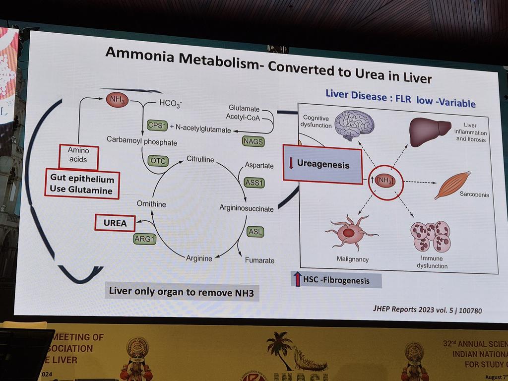 M PREMKUMAR (@docmpk) on Twitter photo INASL2024 Meeting at Kochi. Prod SK Acharya on Ammonia in Liver Disease. ๐ฅ ALF, Sarcopenia, ACLF, MASLD and Cirrhosis. Prof BN Tandon Oration.
<a href="/INASL_Liver/">INASL</a> <a href="/shivaramsingh/">Shivaram P Singh</a> <a href="/ajay_duseja/">Ajay Duseja</a> <a href="/DrAshish_Kumar/">Dr Ashish Kumar</a> <a href="/JCEH_Hepatology/">Journal of Clinical and Experimental Hepatology</a> <a href="/RoyAHep/">Akash Roy</a> <a href="/AnandVKulkarni2/">Anand V Kulkarni</a> <a href="/drshalimar/">Shalimar</a> INASL2024 Meeting at Kochi. Prod SK Acharya on Ammonia in Liver Disease. ๐ฅ ALF, Sarcopenia, ACLF, MASLD and Cirrhosis. Prof BN Tandon Oration.
<a href="/INASL_Liver/">INASL</a> <a href="/shivaramsingh/">Shivaram P Singh</a> <a href="/ajay_duseja/">Ajay Duseja</a> <a href="/DrAshish_Kumar/">Dr Ashish Kumar</a> <a href="/JCEH_Hepatology/">Journal of Clinical and Experimental Hepatology</a> <a href="/RoyAHep/">Akash Roy</a> <a href="/AnandVKulkarni2/">Anand V Kulkarni</a> <a href="/drshalimar/">Shalimar</a>
