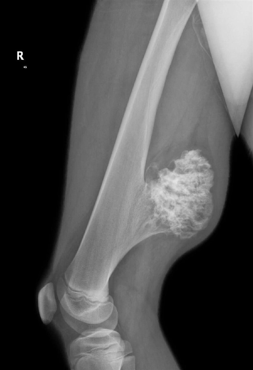 IhabFathiSulima's tweet photo. What is the diagnosis? https://t.co/2VEPxnqECw