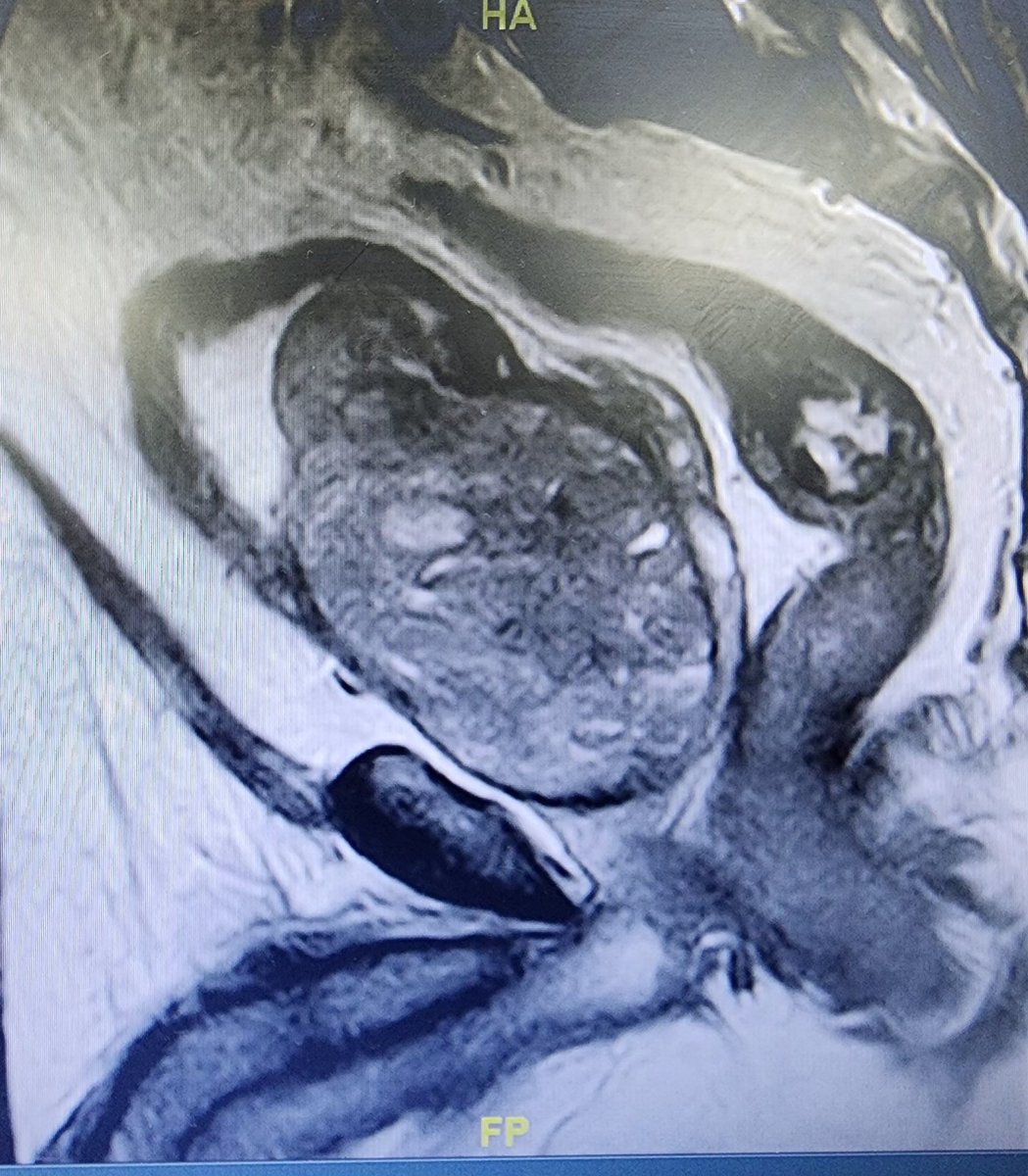 mahmoud nabil laymon tweet media